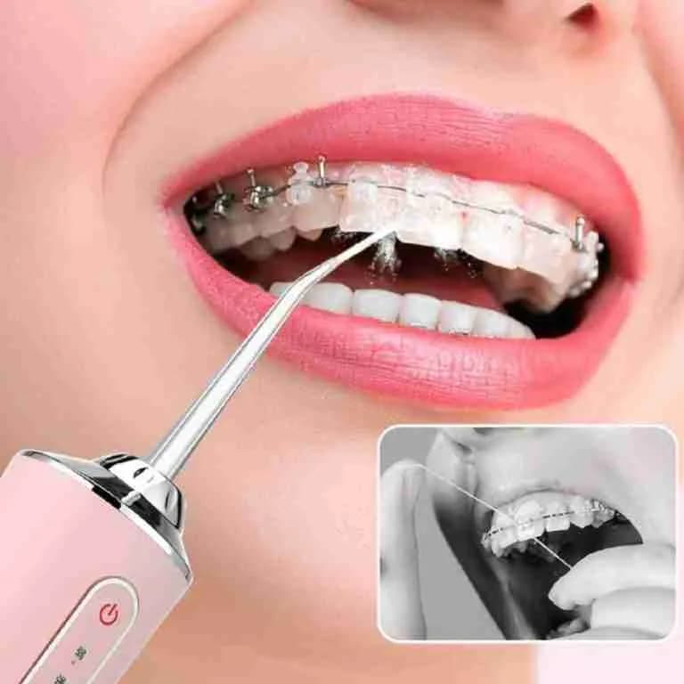 Aparelho Higiene Dental Bucal Jato D`Água Irrigador Portátil