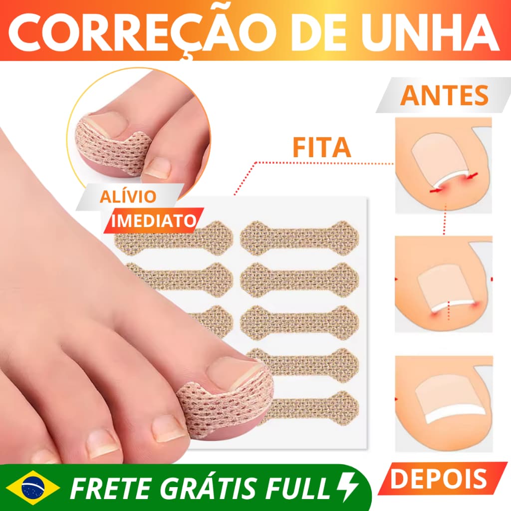 KIT 40/30/20/10/5 Fita de Correção de Unha encravada, Cuidados unha encravada dos pés, Podologia Kits