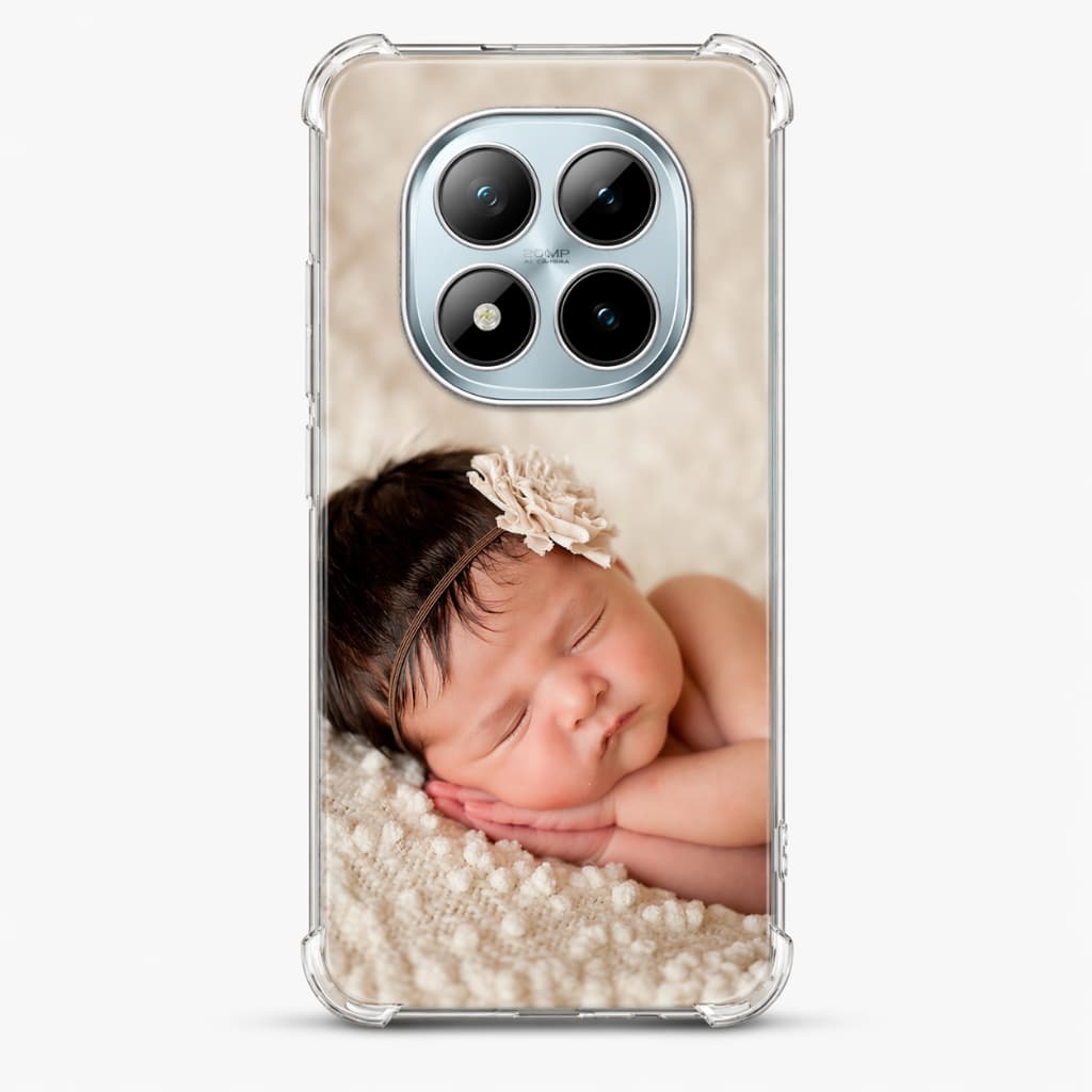 Capinha para Xiaomi Redmi Note 15 4G Personalizada com Foto  - Anti Impacto