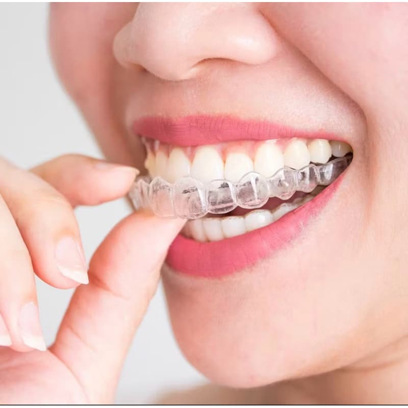 Placa Protetor Bucal Moldável próprio para os dentes Práticas Esportivas