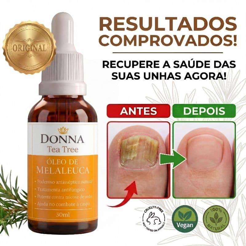 Óleo Melaleuca Tea Tree Donna 30ml 100% Natural Micose Pele Unhas Caspa Frieiras Secagem Rapida