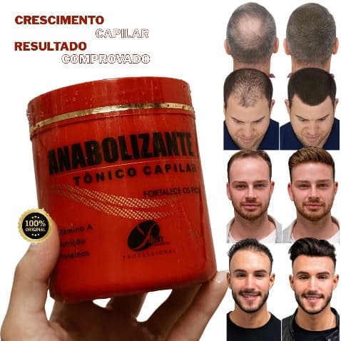 Tônico Vitamina para Cabelo masculino Crescimento Capilar Acelerado Tonico para Homem ORIGINAL YLLEN