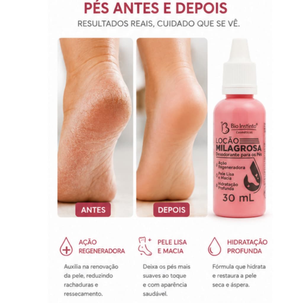 Kit  Loção Milagrosa Para os Pés Bio Instinto 30ml | Combate Rachaduras, Ressecamento e Mau Odor