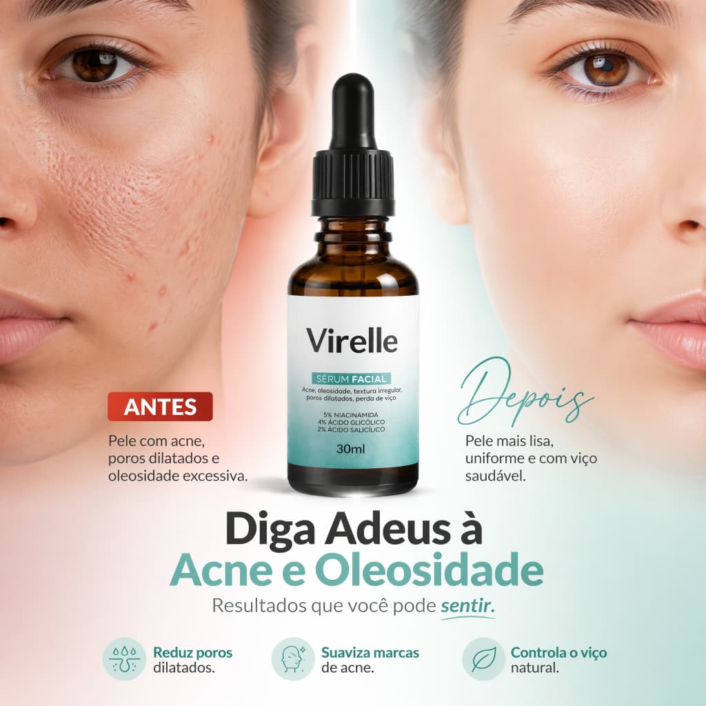 Virelle SERUM FACIAL 5% NIACINAMIDA4% ACIDO GLICOLICO2% ACIDO SALICILICO - Lightens Acne and Melasma Spots - Evens Skin