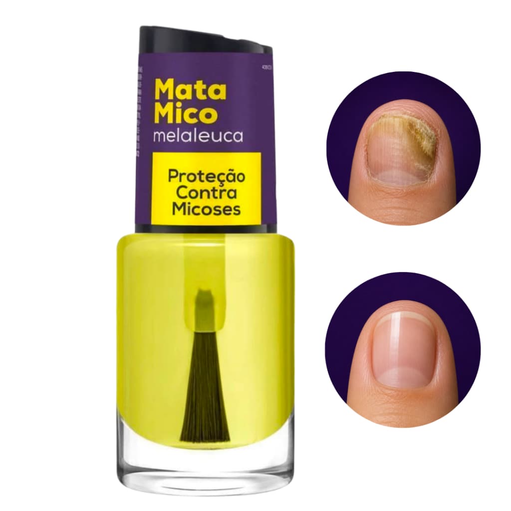 Kit base Mata Mico Oleo com Melaleuca - Regenera a Unha, 10ml Cora