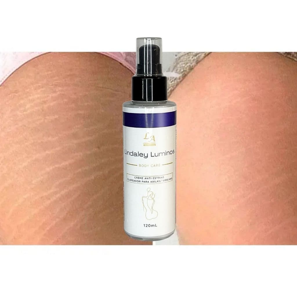 Lindaley Luminos Clareador - Anti Estrias Clareador de Axila, Virilha, Joelhos 120ml Entrega rápida