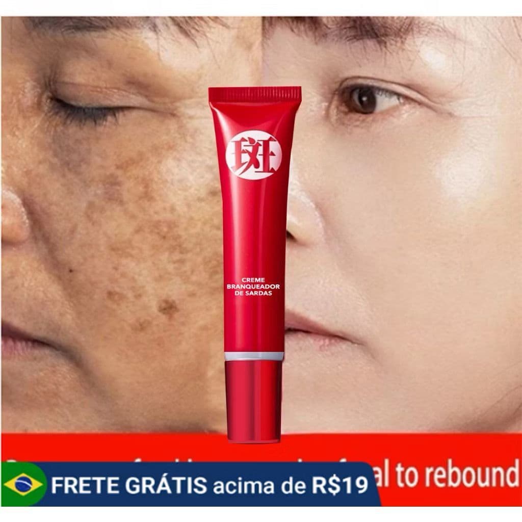 Creme forte original para remover manchas escuras/clareamento pigmentado/cuidados com a pele