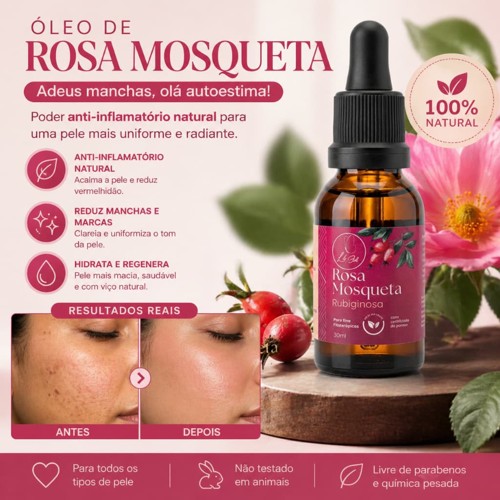 Óleo Vegetal de Rosa Mosqueta Rubiginosa 30ml Puro - Clareador de manchas