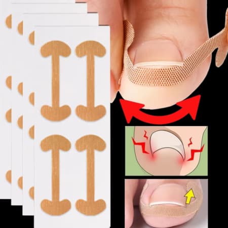 Kit de 4 a 20 Adesivos Corretores para Unhas Encravadas - Uso Profissional e Doméstico