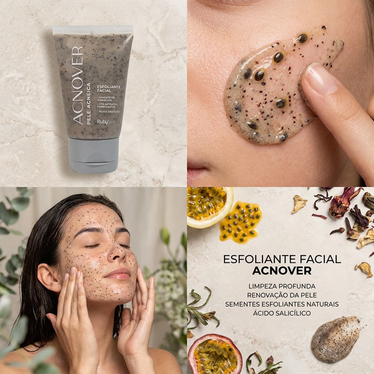 Esfoliante Facial Anti Acne Acnover Ruby Rose 120g Dia Noite Hipoalergênico Limpeza Facial Cuidado