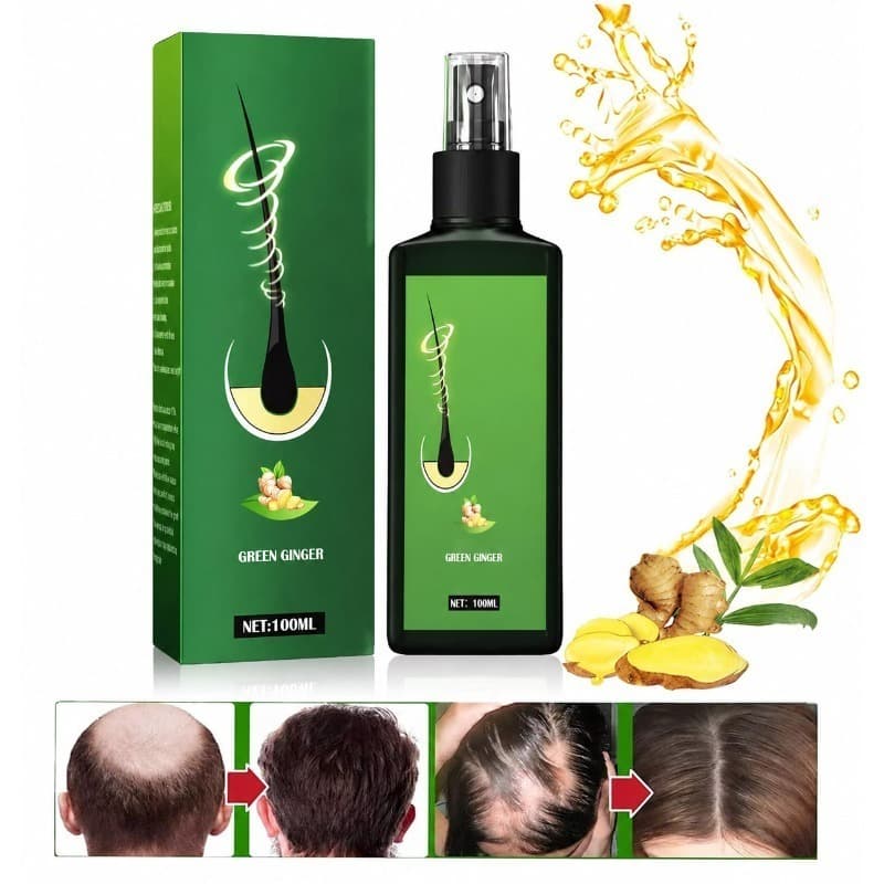 Sérum Spray Capilar Plantas Naturais Crescimento Fortalece Previne Queda