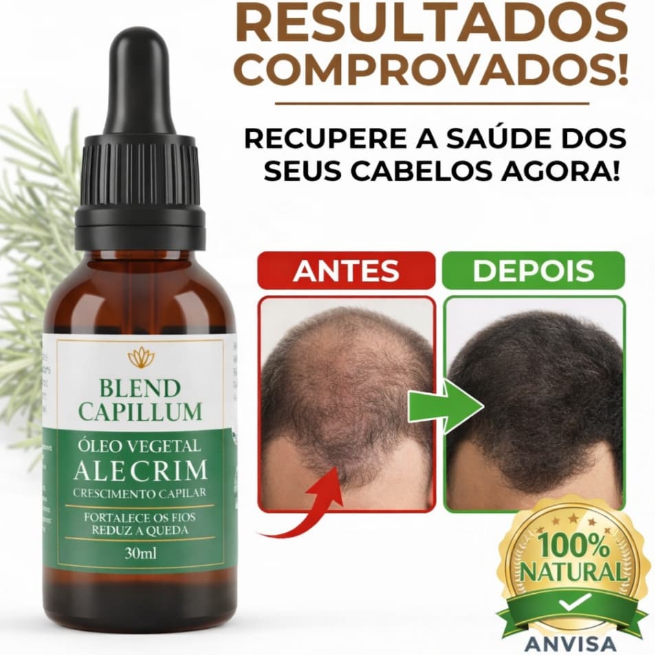 Óleo Alecrim Crescimento Fortalecimento Capilar Barba 100% Natural Vegano 30ml Pronto uso