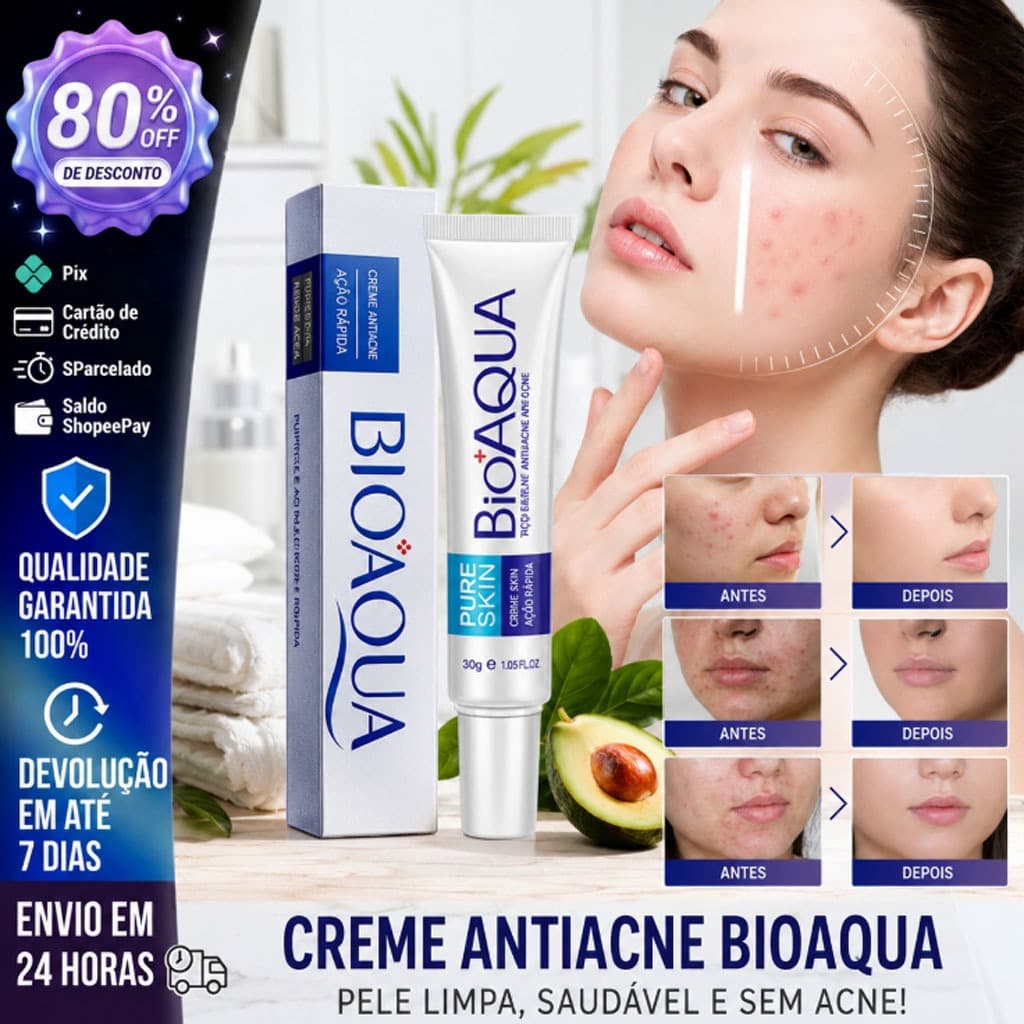 Bioaqua Creme De Remoção De Espinhas Para Cicatrizes/Tratamento Anti-Acne/Clareamento/Controle De Oleosidade
