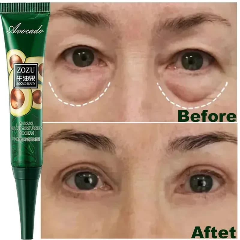 Abacate Tighten Wrinkles Eye Cream Anti Dark Circles Bags Puffiness Fade Fine Line Whiten Under Eyes Skin Cuidados Com A Pele Coreana , Extrato De Essência Creme Hidratante Elástico Para Os Olhos