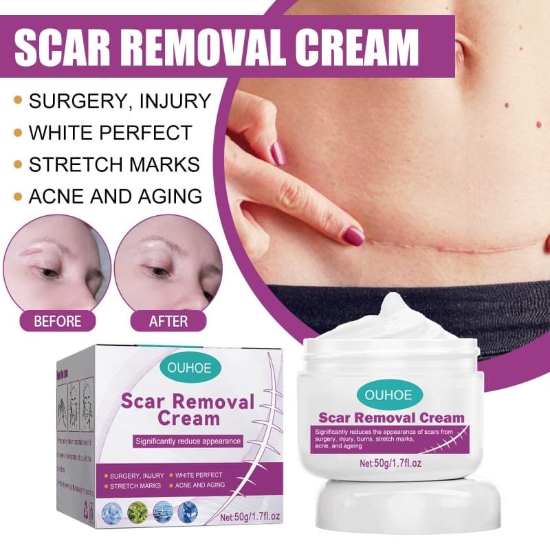 Creme Cicatrizante Removedor de Cicatrizes Antigas Queloides Estrias Acne Cirurgia 50g