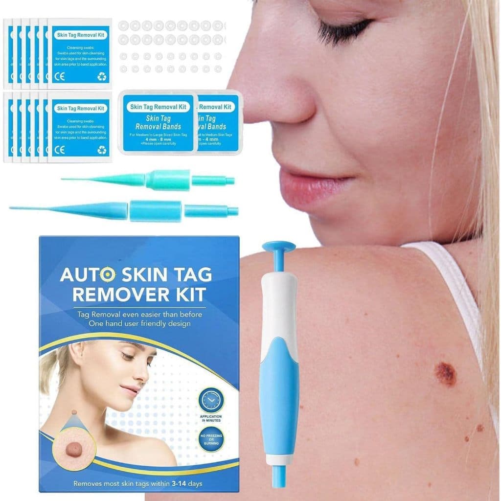 Conjunto de remoção de sebo físico em miniatura caneta de remoção de sebo ferramenta de beleza Facial