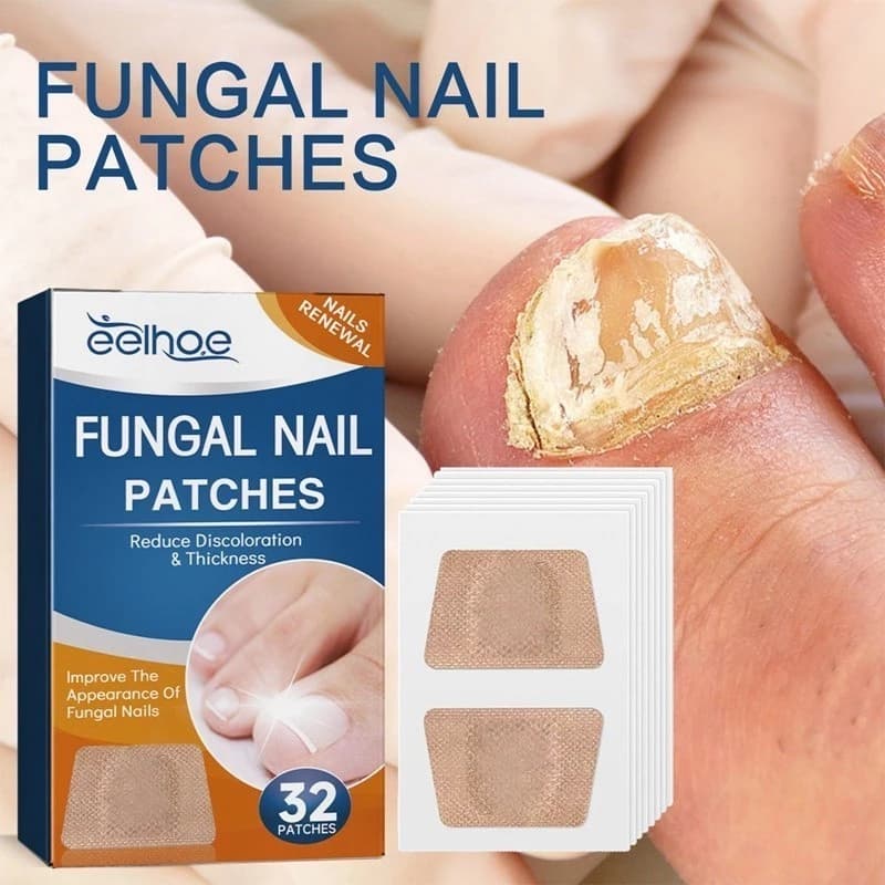 32/64PCS Adesivo Reparador de Unhas dos Pés Cinza Fungo Unha Espessa Correção de Unhas das Mãos Infecção Paroníquia