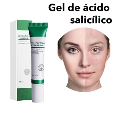 Creme de Ácido Salicílico 20g, Usado para Remover e Poros Finos/Acne/Controle de Oleosidade