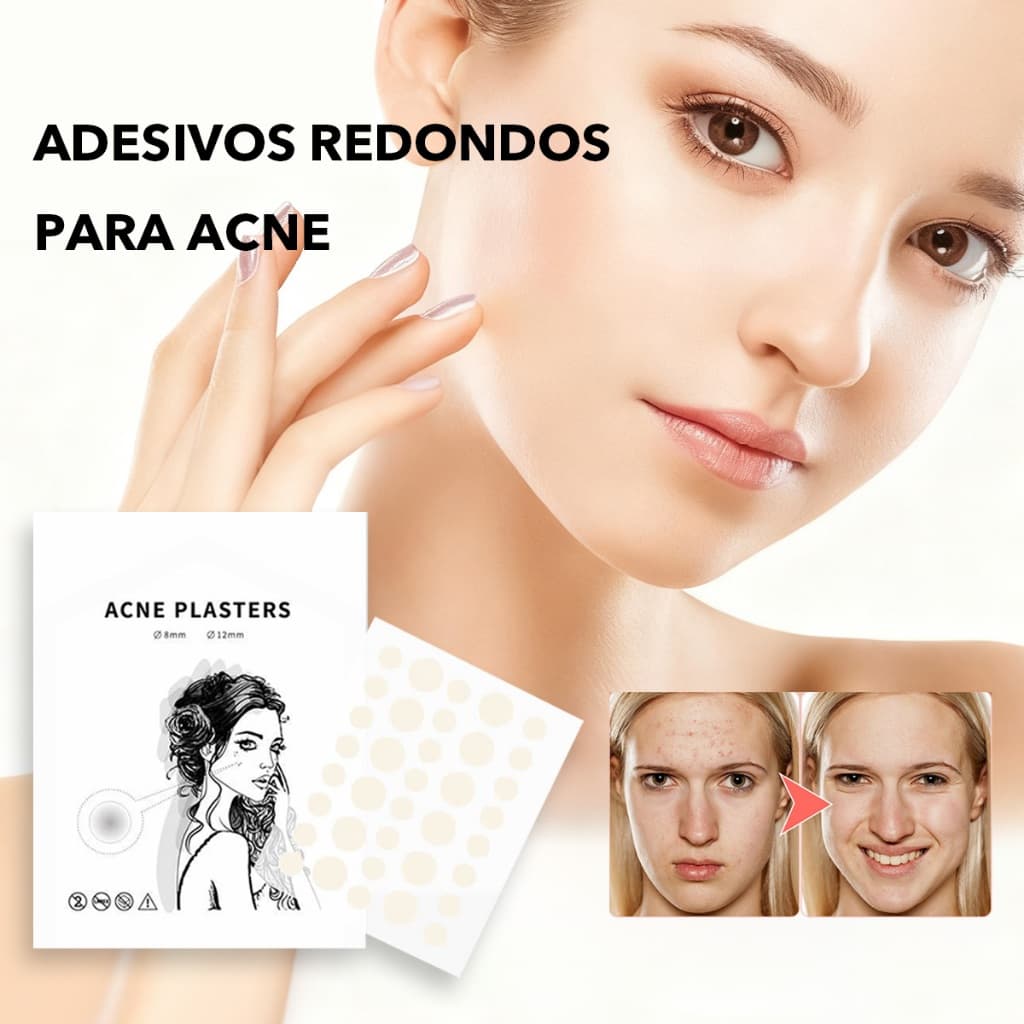 2/3/5 pcs de adesivos aquosos para acne, adesivos principais para acne, conjunto, adesivos redondos para acne