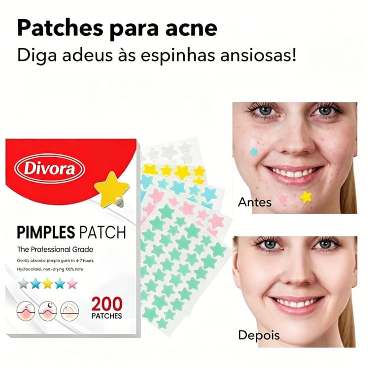 Patch Para Remoção De Acne , Pacote Familiar De 200 Peças , Alto Custo , Respirável Invisível , Entrega local