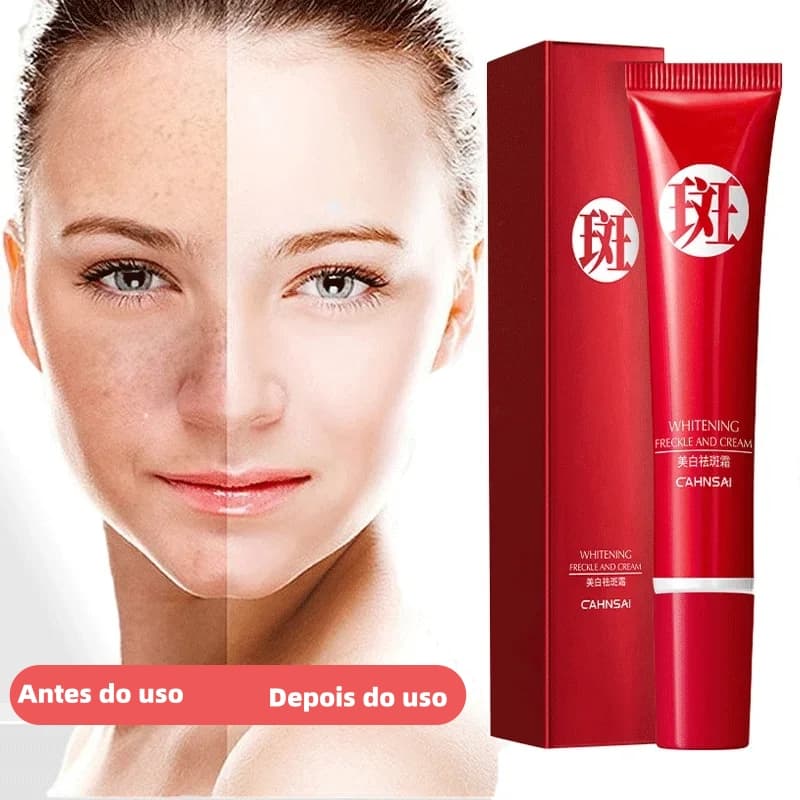 Creme clareador para remoção de sardas/remover manchas escuras e cuidados com a pele