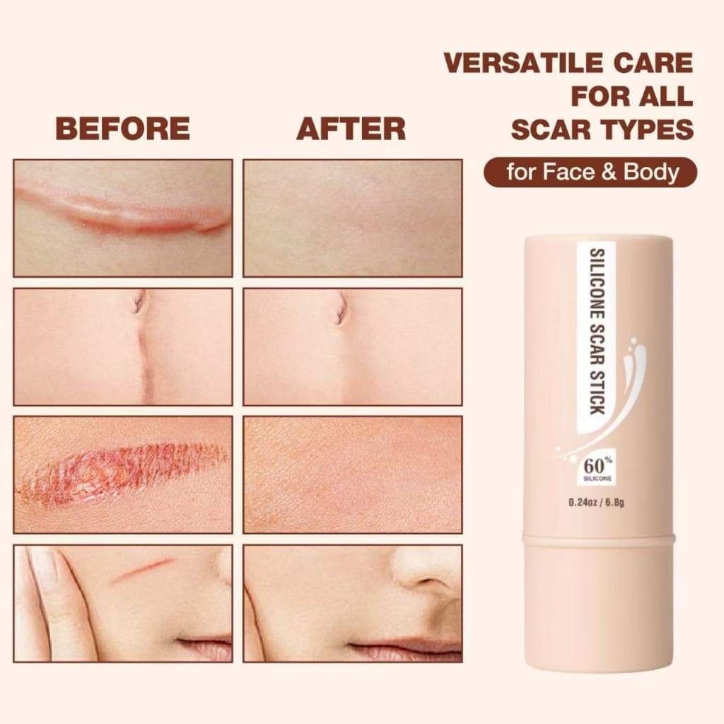 【Oferta Limitada】Bastão Reparador Centella Asiática Vitamina E | Regenera Pele | Melhora Marcas e Estrias | Rosto Corpo