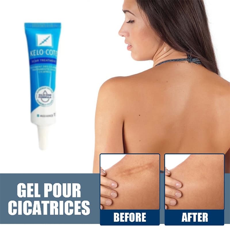 15g creme de compressa fria novo estilo Gel reparação suavização suavização suavização hidratante cuidados com a pele