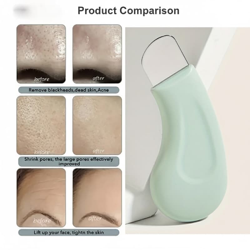 Raspador De Cravo E Acne De Silicone – Ferramenta De Limpeza Facial Para Uso Doméstico Em Beleza