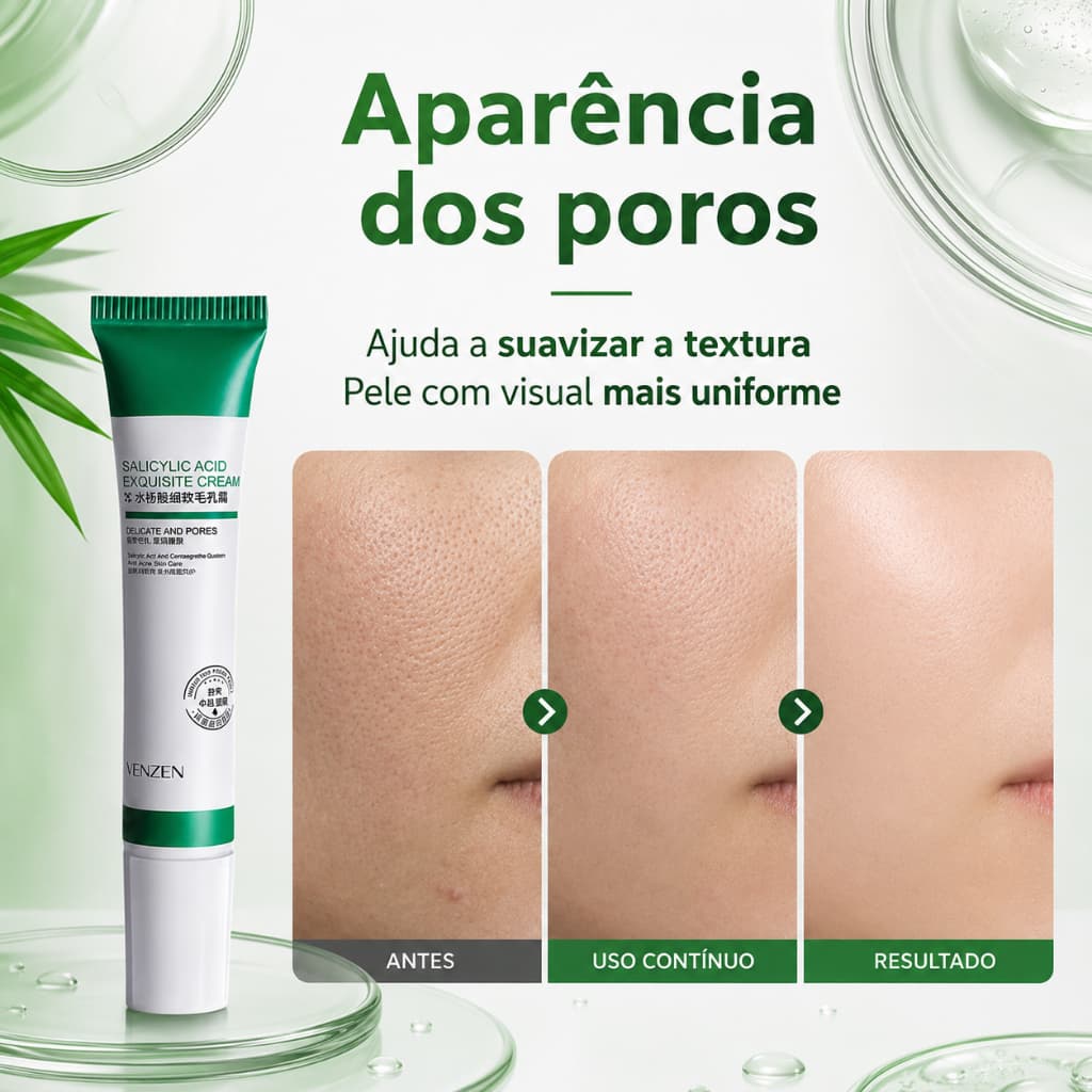 Creme com Ácido Salicílico – 20 g– Indicado para peles oleosas e mistas