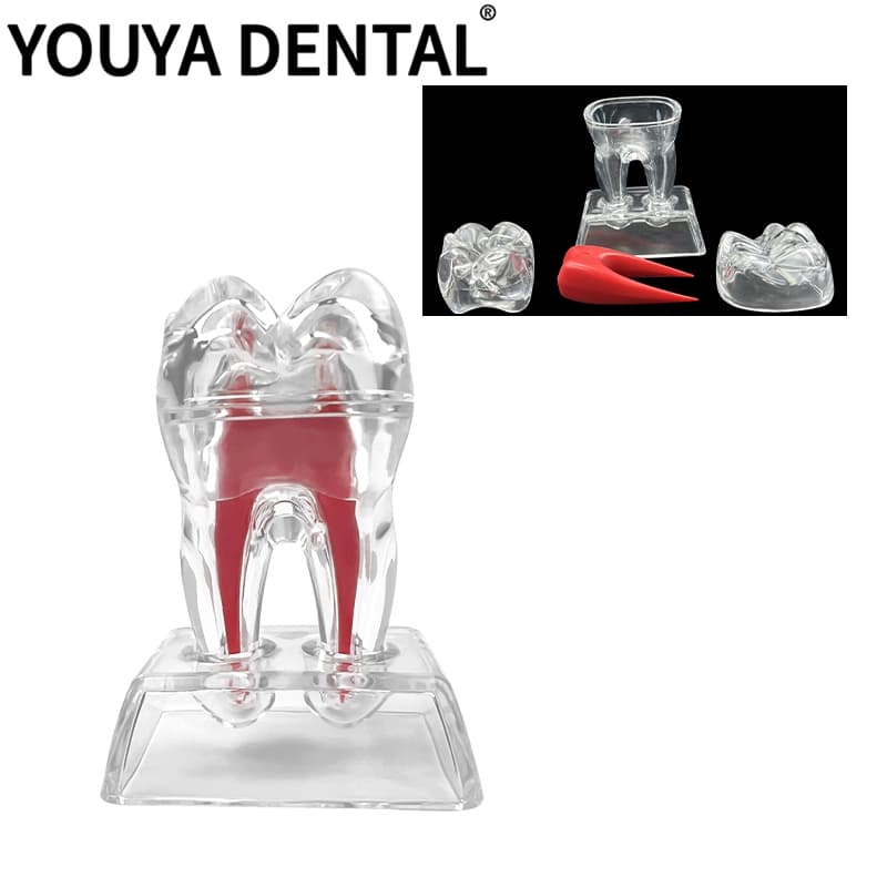 Modelo De Molar De Dente , Demonstração De Ensino Dental Decomposição Transparente