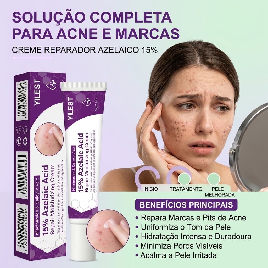 Creme Suavizador de Marcas de Acne 20ml | Ácido Azelaico 15% Hidrata Repara Refina Poros Controla Oleosidade