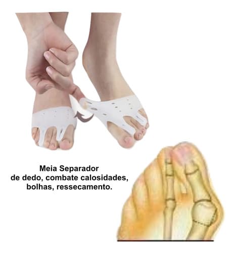 Almofadas Para Metatarsos Separador De Dedo Hallux Alívio