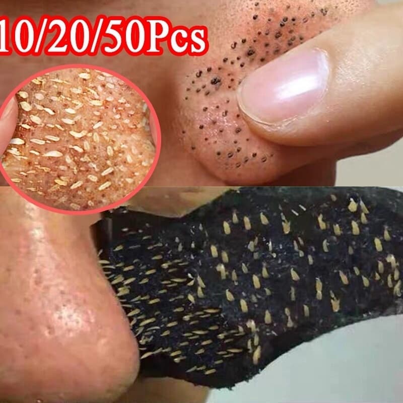 10/20/50/100 Unidades Máscara De Nariz Descascar Adesivo Tiras De Limpeza De Poros Removedor De Cravo Preto