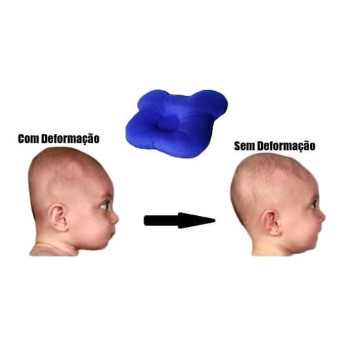 Travesseiro Que Evita Cabeça Chata - Plagiocefalia Ursinho
