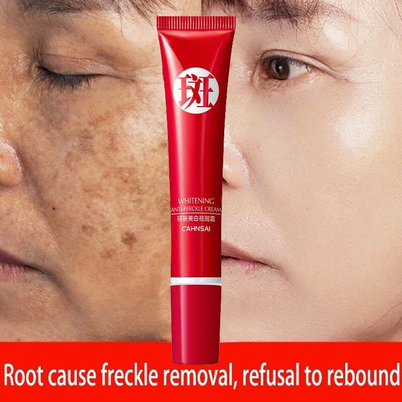 Creme forte Exclusivo Remove Manchas Escuras/Pigmentação/Cuidados Com A Pele B8V3