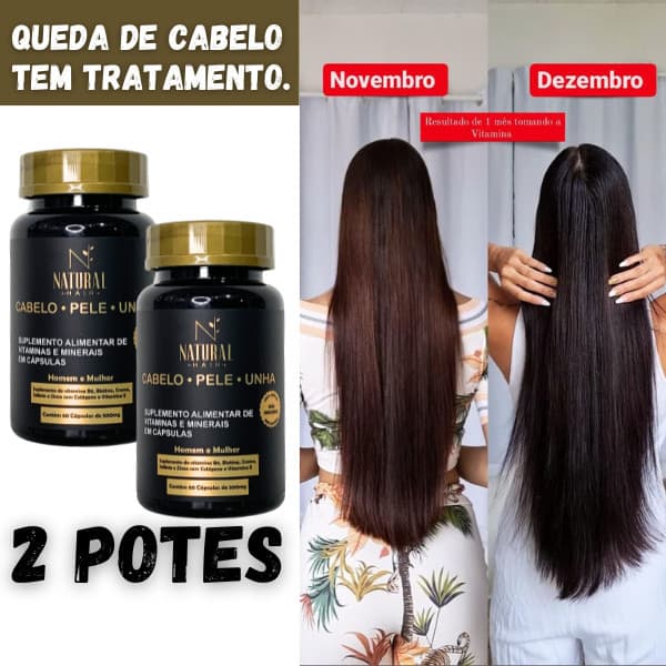 Kit 02 potesTratamento Antiqueda Cabelos Crescer Cabelo 120 Capsulas
