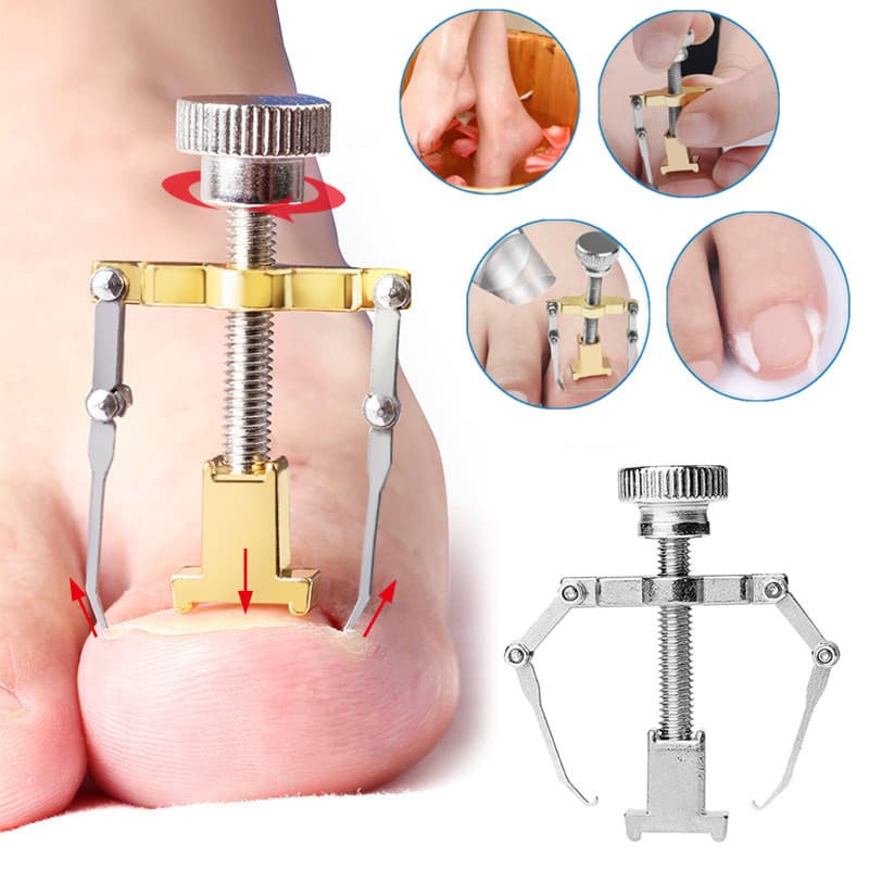 Ferramenta De Pedicure Corretora Clip Paronychia Cure Ingrown Toenails Alisamento Das Unhas