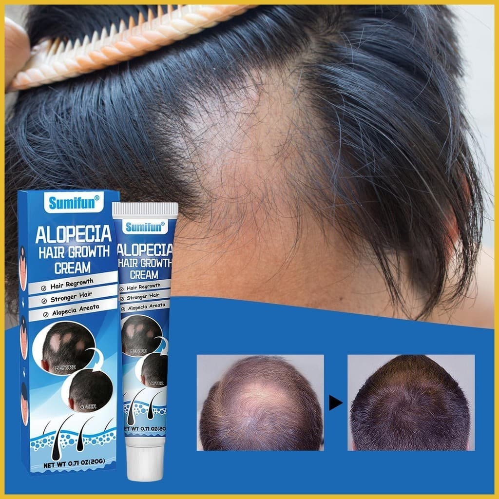 Creme Para Calvície Masculino 20g Cabelos Densos Beleza Cuidados Com O Cabelo Sem Alta Linha Aumento Rápido yushua2br
