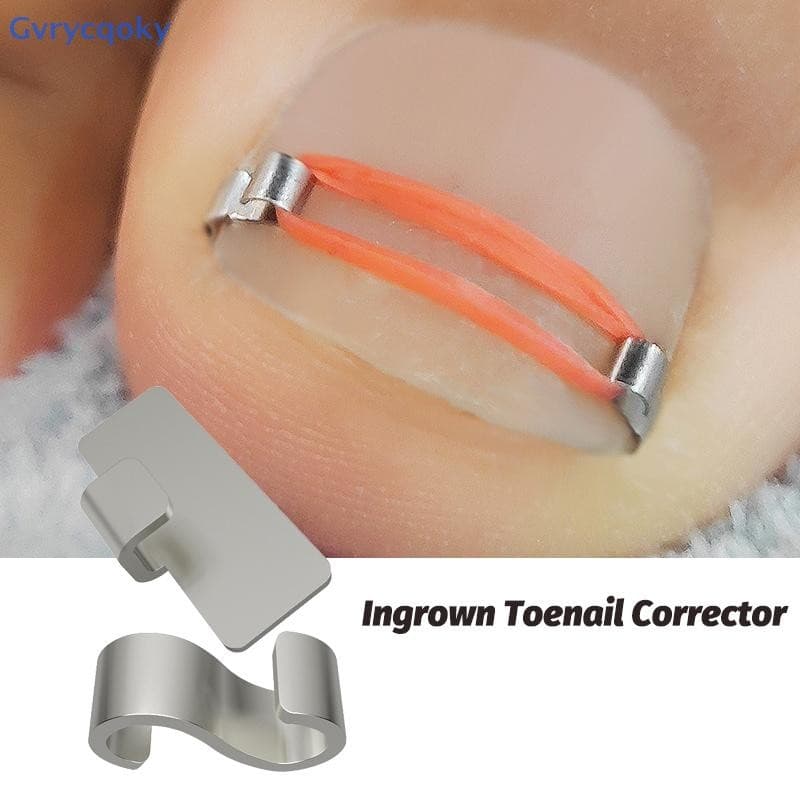 Gvrycqoky Ferramentas Corretoras De Unhas Encravadas , Pedicure , Recuperação , Tratamento Correção Ferramenta De Cuidad