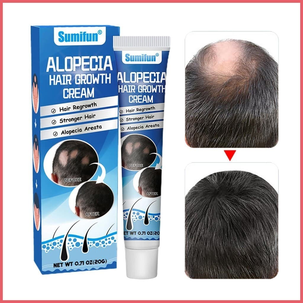 Essência De Crescimento Capilar 20g Anti Alopecia Óleo Rápido Para Cabelos