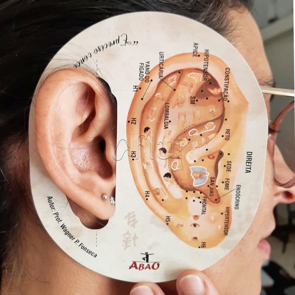 Gabarito para Prática e Atendimento de Acupuntura Auricular Wagner