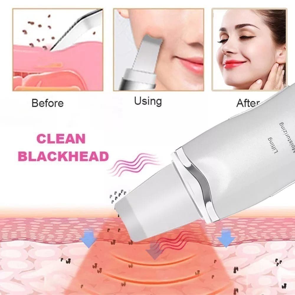Aparelho Peeling Ultrassônico Limpeza Facial Profunda Removedor de Cravos Esfoliante Facial Antirrugas Recarregável USB