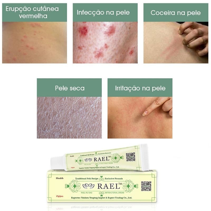 1Pc YIGANERJING RAEL Pomada Creme Corporal Para Cuidados Com A Pele