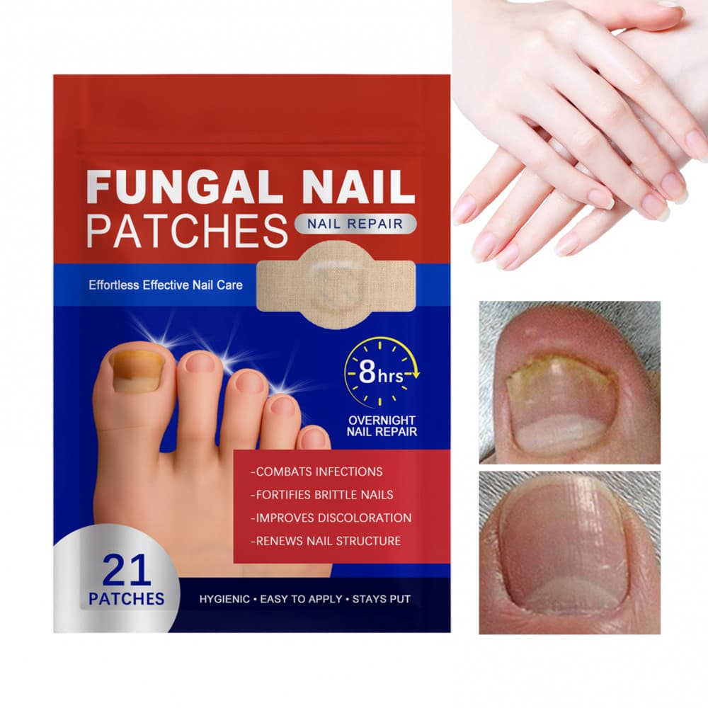 Remendos De Unhas Fúngicas De Renovação Noturna 21 Pcs Patches De Reparo Multiuso Remendo De Tratamento De 8 Horas Para