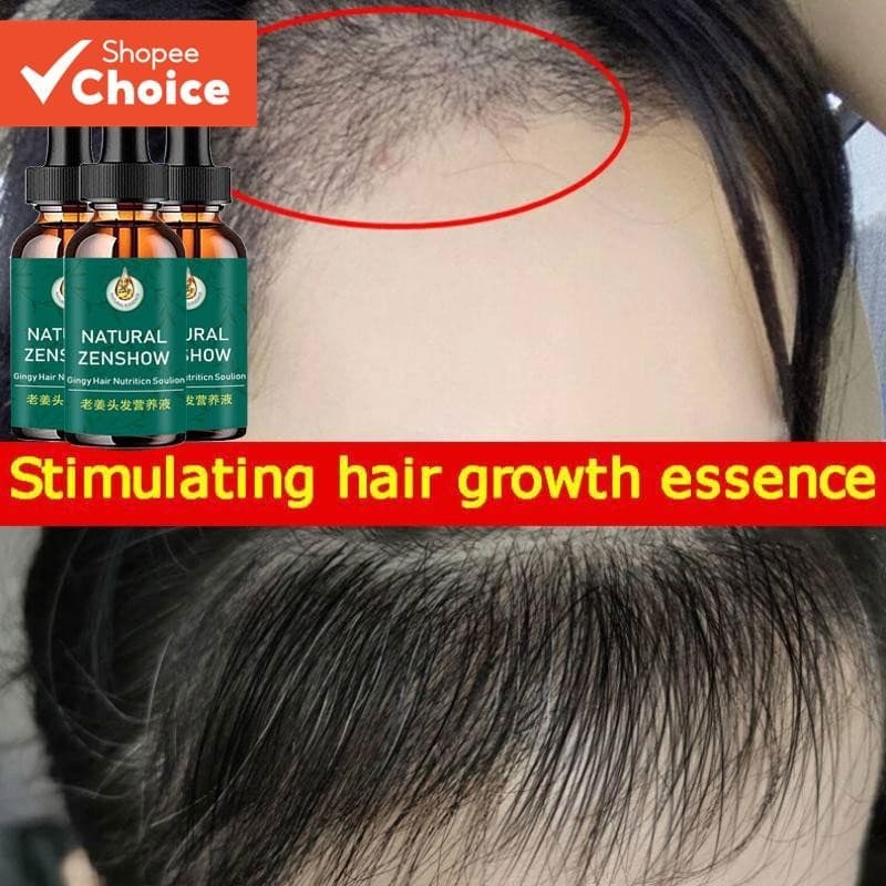 África Óleo Essencial K3X4 Para Crescimento de Cabelos Capilar Tração Louco Gengibre Selvagem Prevenir Alopecia