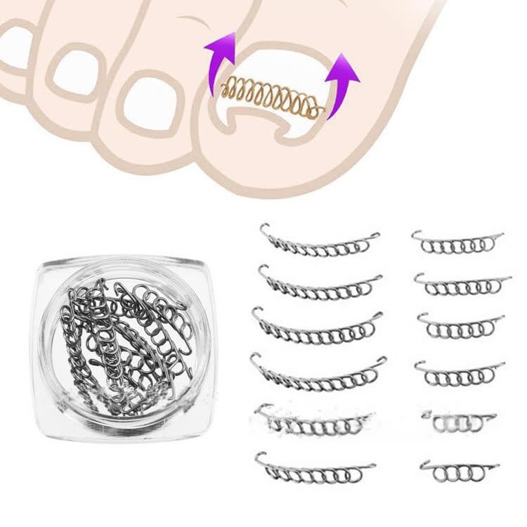 12 Mola Órteses Desencrava Corretor Unha Encravada Aço Inox
