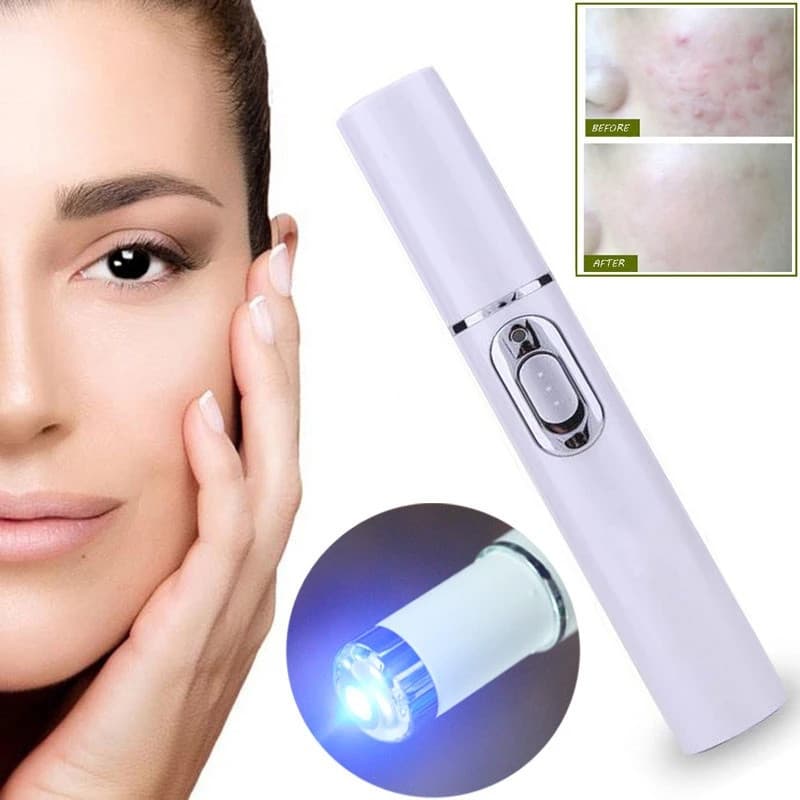 Caneta Laser KD-7910 para Tratamento de Cicatrizes de Acne e Varizes