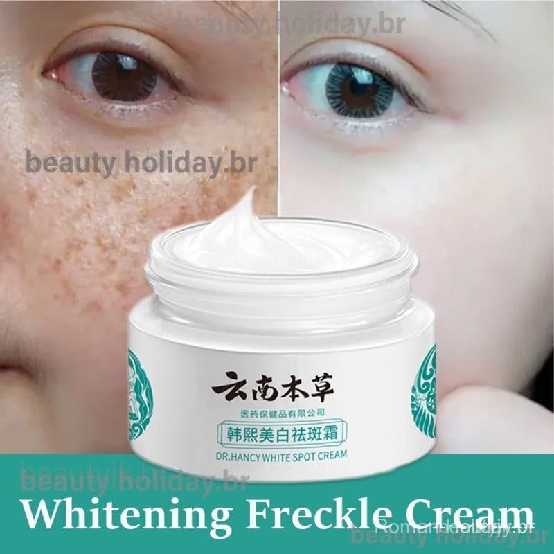 Creme De Melasma Japonês Yunnan Ervas Branqueamento Original Alta Hidratação Queimadura Solar Sarda Removedor De Cloasma