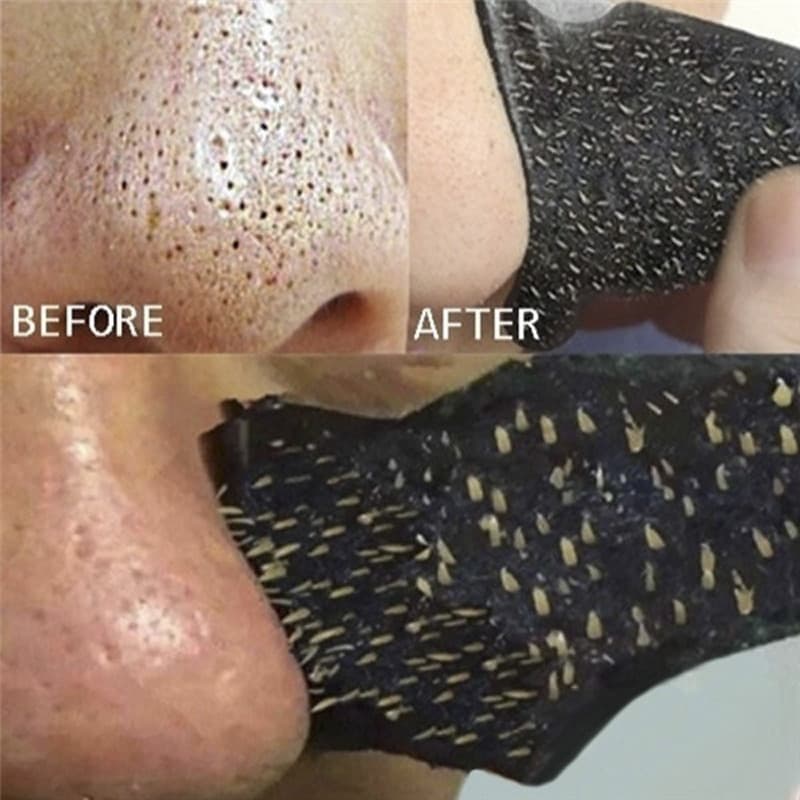 10 Pçs Pasta De Nariz De Limpeza Profunda Carvão De Bambu Removedor De Cravo Ponto Nasal Tira Forte Adesivo Ferramentas