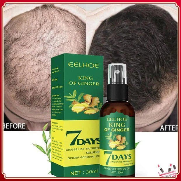 7 Dias de Eelhoe King Of Ginger Spray de Crescimento Capilar Prevenção da Queda de Cabelo Promove o Crescimento Capilar